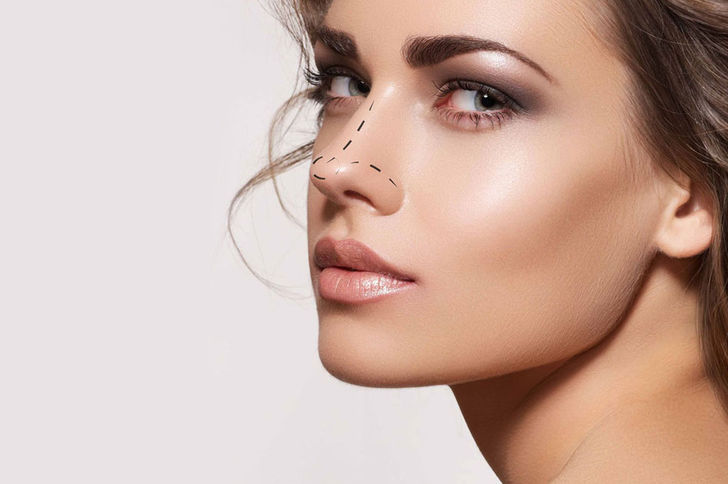 Rhinoplasty / Nose job Nashik Rhinoplasty / Nose job Nashik