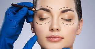 blepharoplasty surgery in nashik