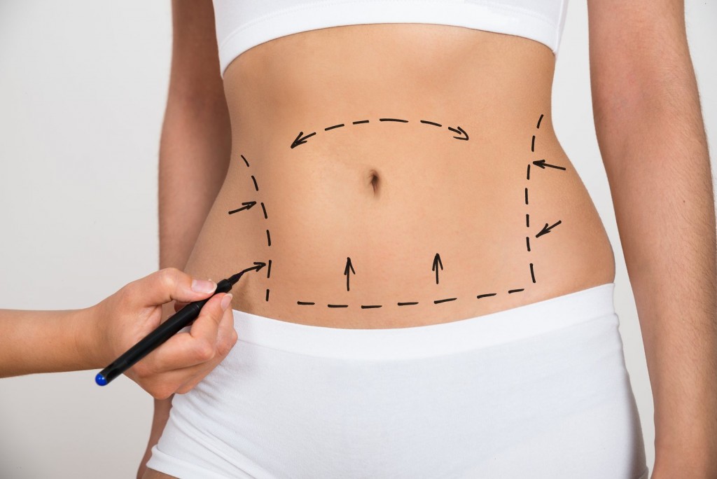 fat reduction and body reshaping in nashik