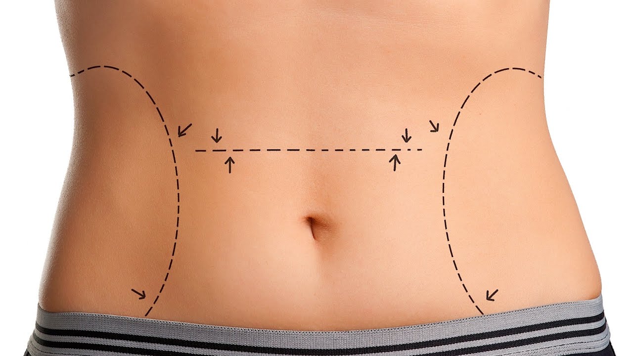 Tummy Tuck Surgeon in Nashik | Dr.L.M.Dyanand plastic surgeon in Nashik