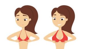 Breast Augmentation with implant In Nashik | Symphony Clinic Breast Augmentation with implant In Nashik | Symphony Clinic